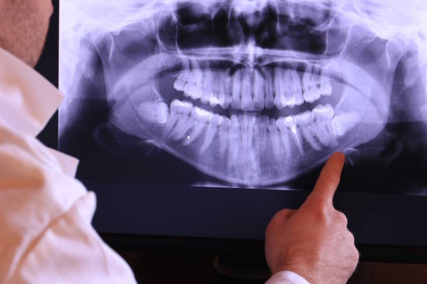 Best Broken or Cracked Tooth Emergency Dentist in Sandy Oaks, TX
